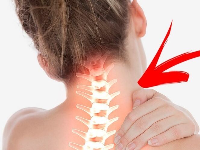 Mkpakọ nke akwara na osteochondrosis calrical