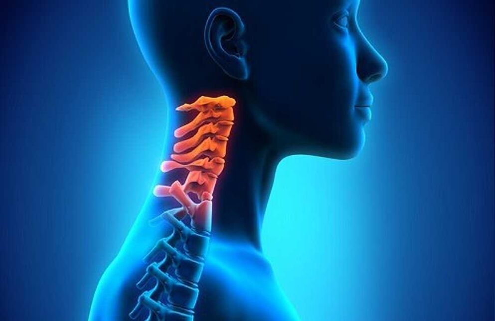 mgbu na spine cervical