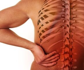 azụ mgbu na lumbar osteochondrosis